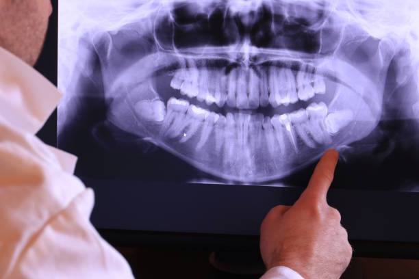 Urgent Tooth Repair in MD