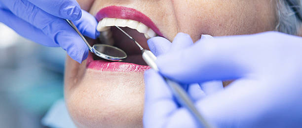 Best Emergency Tooth Extraction  in Colesville, MD
